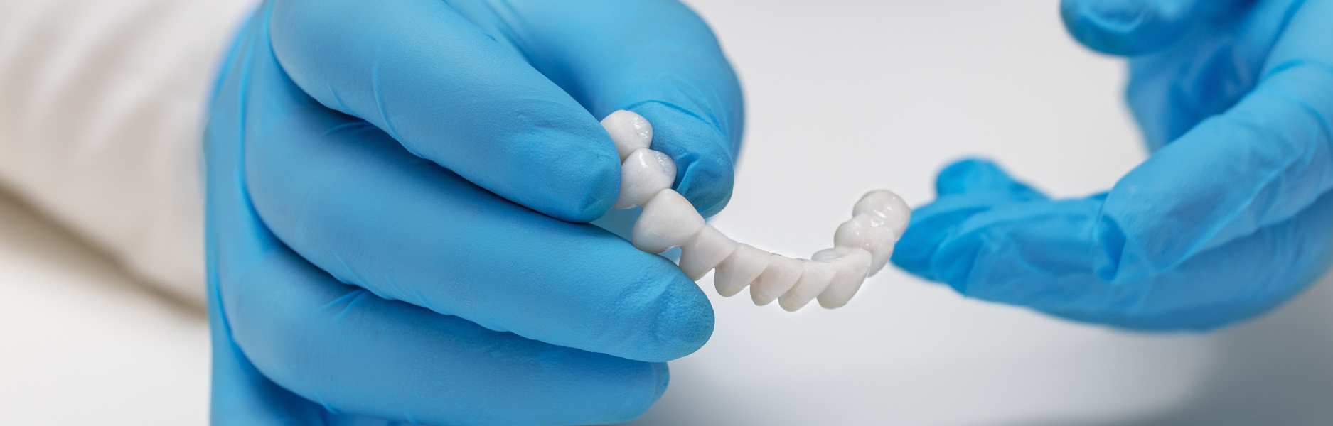 Revolutionizing Smiles: The Comprehensive Guide to Dental Implant Bridges